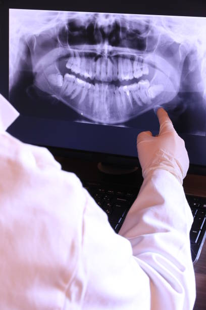 Best Tooth Infection Emergency Dentist  in Sanborn, NY
